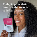 Viviscal Women's Hair Growth – Thicker & Stronger Hair, 90-Day Supply - WONEXA